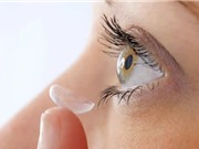 Kính áp tròng giải phóng thuốc điều trị bệnh tăng nhãn áp